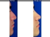 1_4
